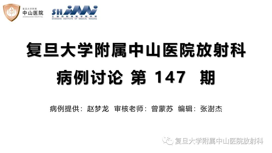 【病例】内淋巴积水(梅尼埃病)一例MR影像