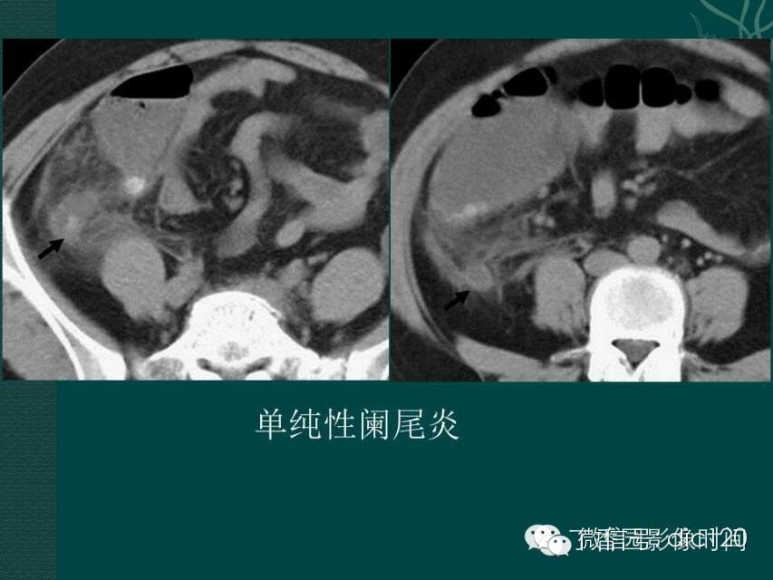 自动草稿
