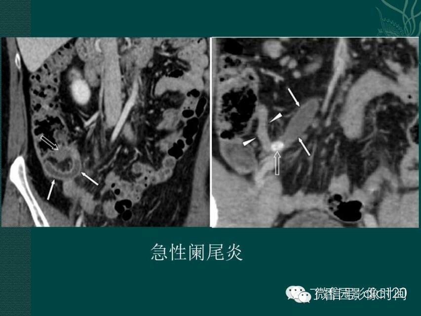 自动草稿