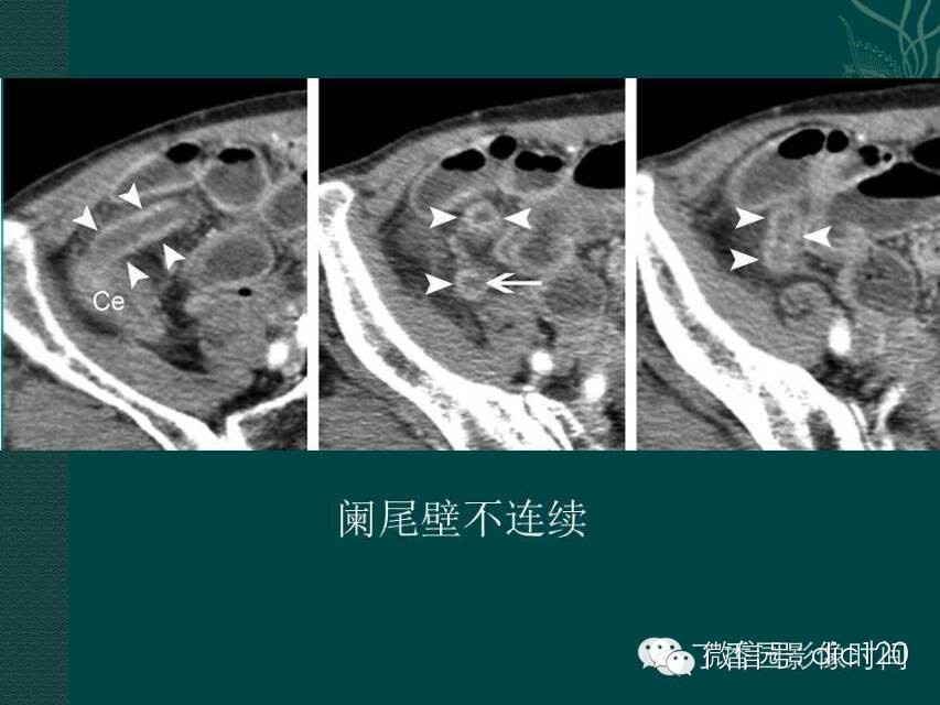 自动草稿