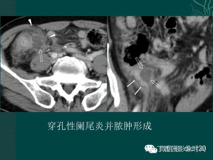 自动草稿