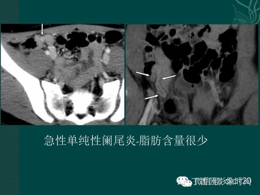 自动草稿
