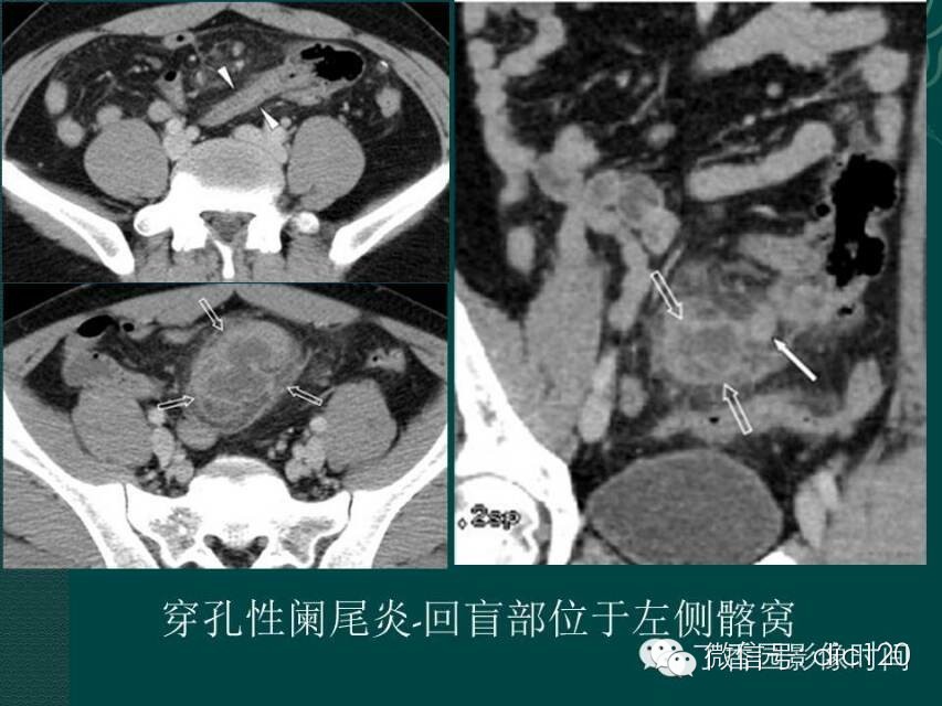 自动草稿