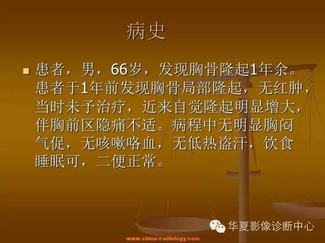 【病例学习】胸骨浆细胞骨髓瘤一例CT诊断与鉴别