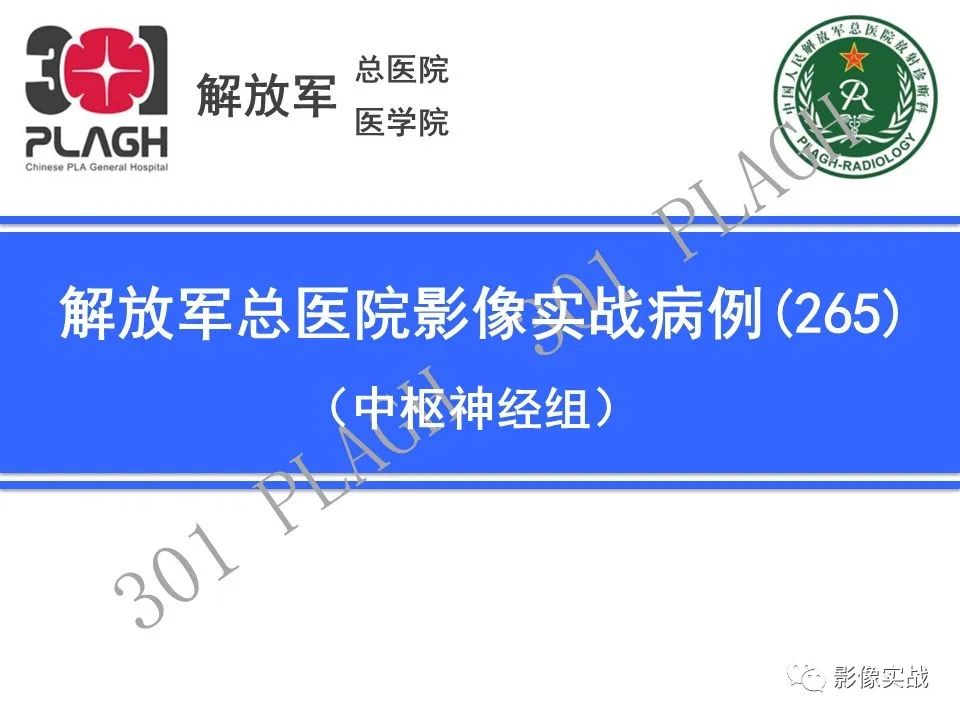 成人小脑髓母细胞瘤1例MR影像