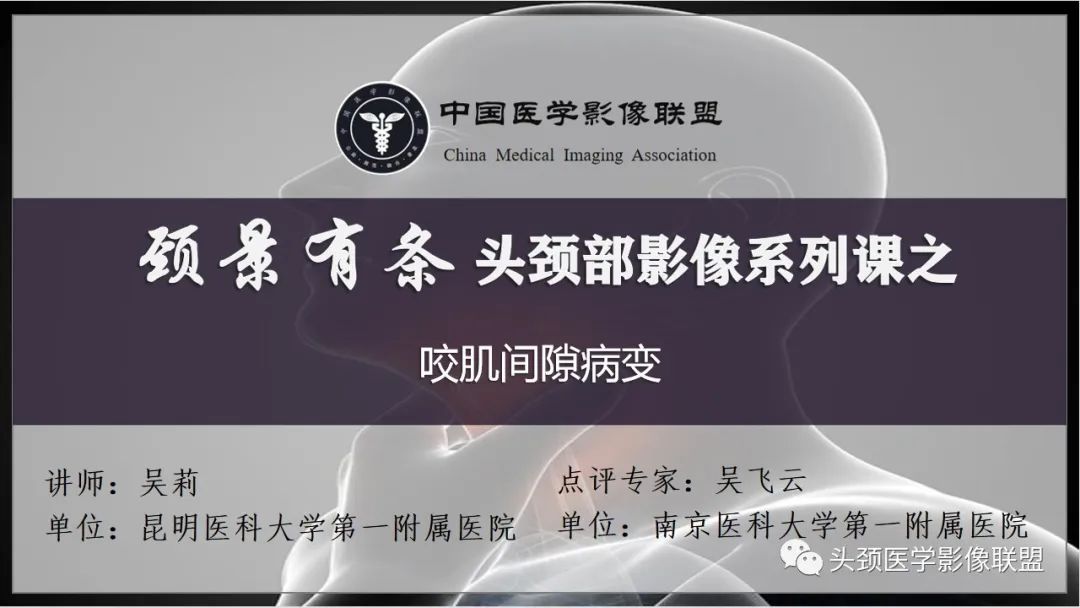 咬肌间隙肌纤维母细胞肉瘤1例MR诊断与鉴别