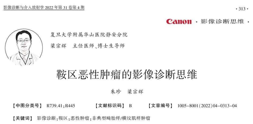 鞍区恶性肿瘤—非典型畸胎样/横纹肌样肿瘤1例CT及MR影像诊断思维