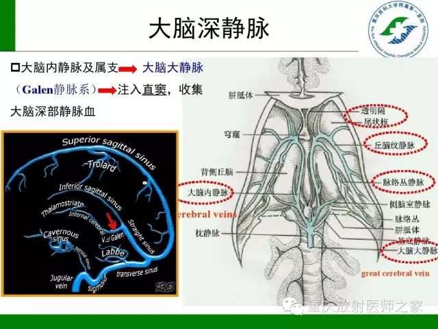 【PPT】脑静脉解剖及相关疾病影像学诊断-9