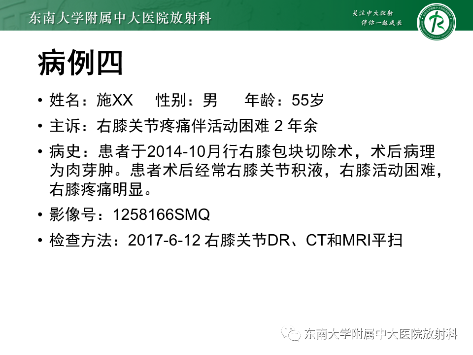 【PPT】膝关节腱鞘巨细胞瘤-25