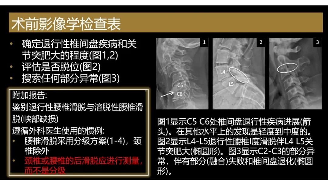 【PPT】评估围手术期脊柱:除了退行性椎间盘疾病和金属植入物的并发症外-7