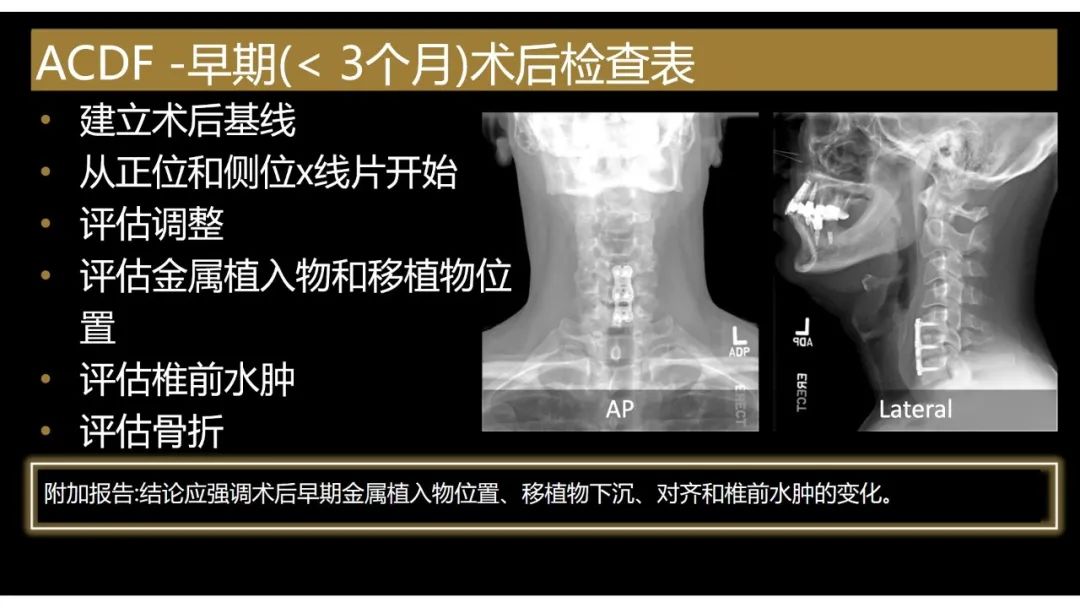 【PPT】评估围手术期脊柱:除了退行性椎间盘疾病和金属植入物的并发症外-19