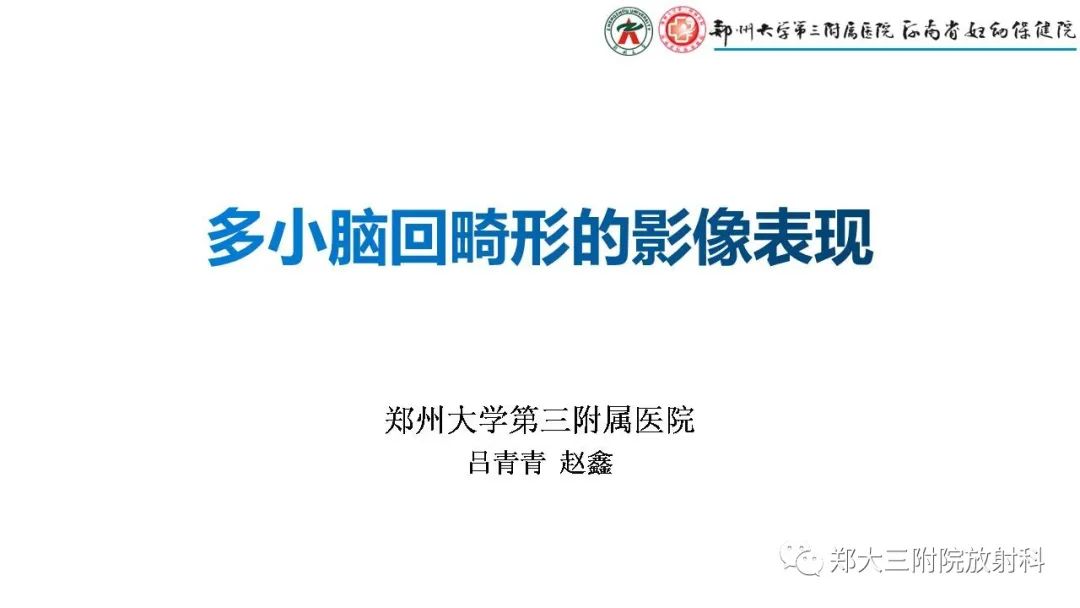 【PPT】多小脑回畸形的影像表现-1