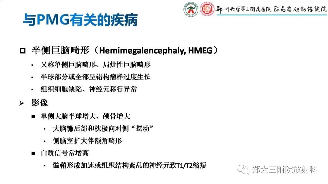 【PPT】多小脑回畸形的影像表现-22