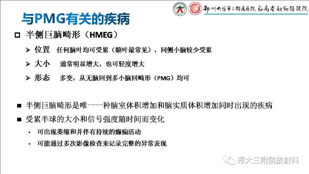 【PPT】多小脑回畸形的影像表现-23