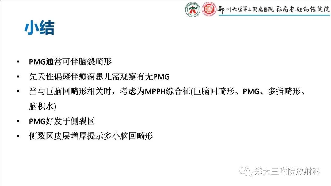 【PPT】多小脑回畸形的影像表现-33