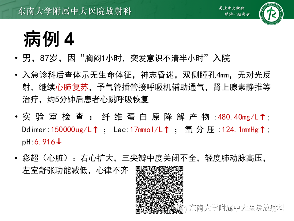 【PPT】成人颅内T1WI高信号病例随访-8