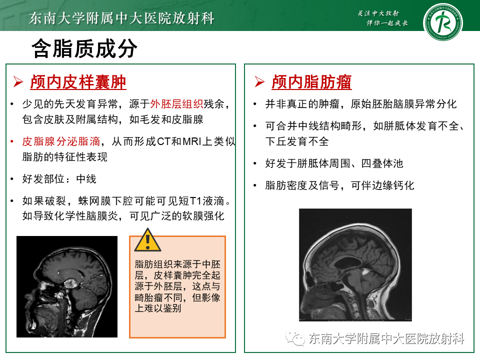 【PPT】成人颅内T1WI高信号病例随访-39