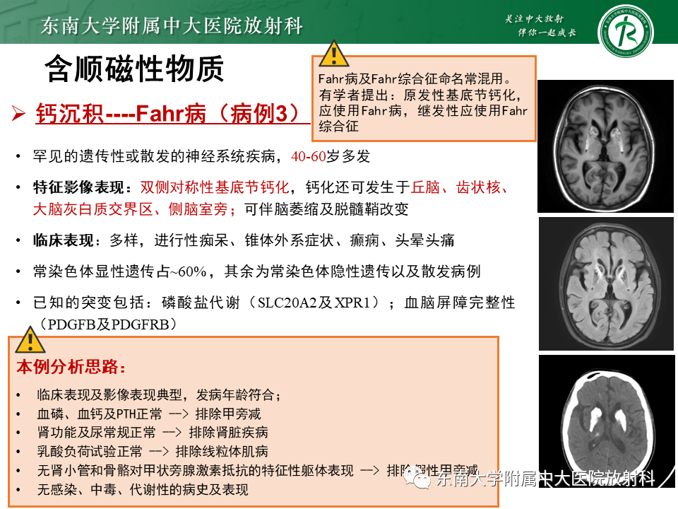 【PPT】成人颅内T1WI高信号病例随访-44