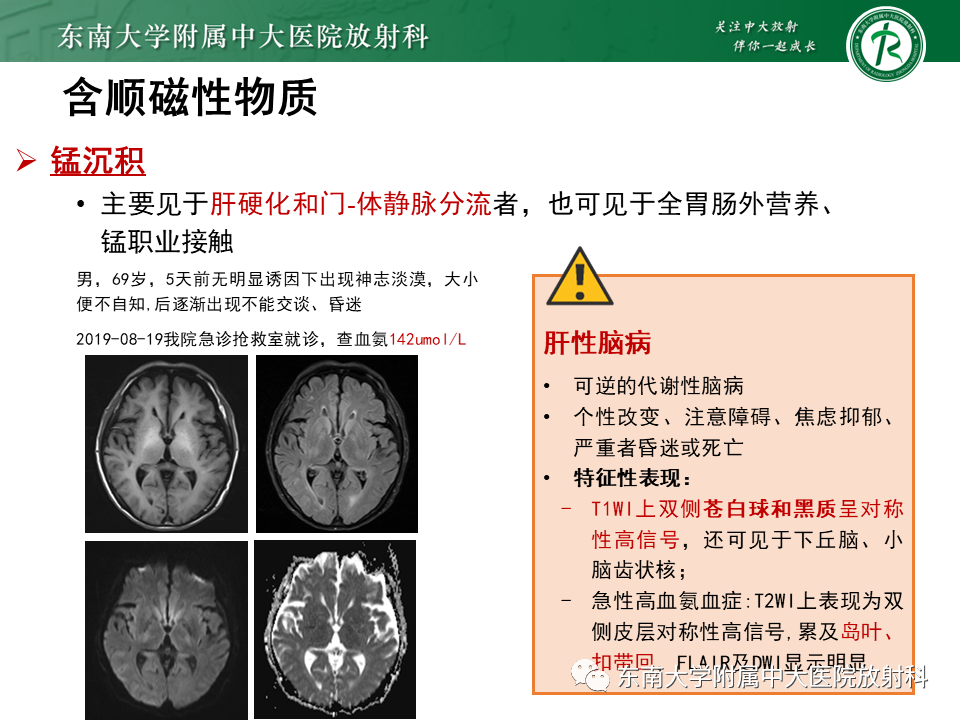 【PPT】成人颅内T1WI高信号病例随访-46
