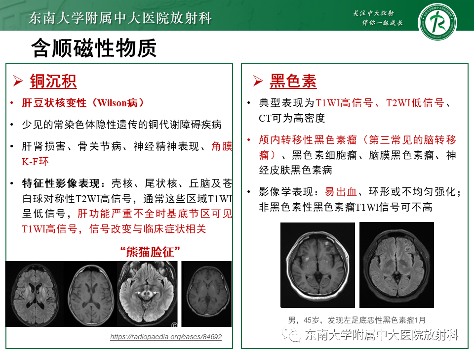 【PPT】成人颅内T1WI高信号病例随访-47
