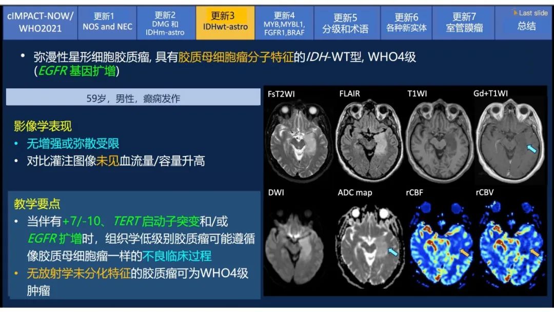 【PPT】中枢神经系统肿瘤的MRI表现：随cIMPACT-NOW一同展望WHO2021分类-22