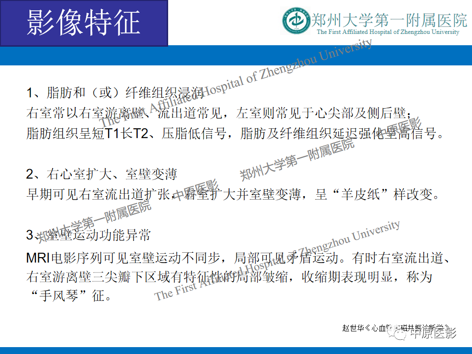 【病例】致心律失常性右室心肌病1例MR影像-14