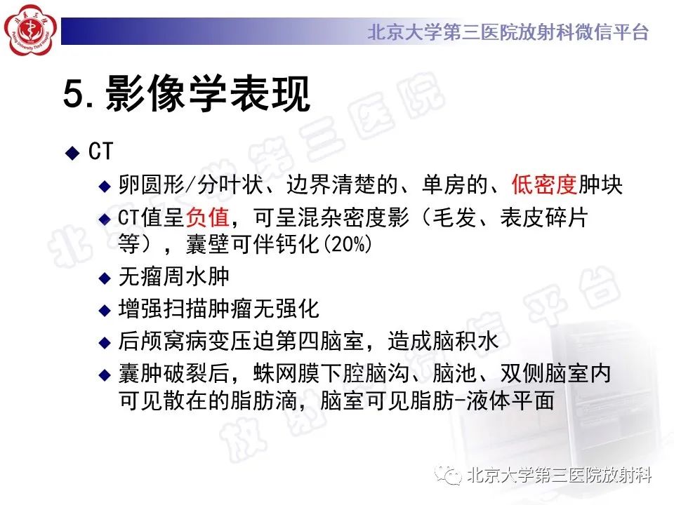 【PPT】颅内皮样囊肿-17