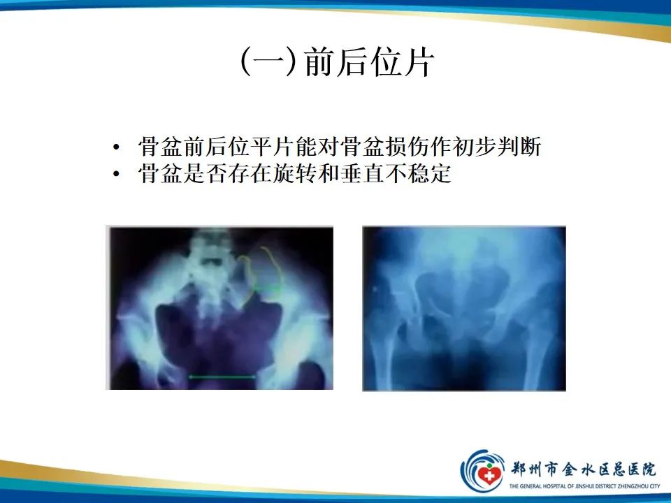 【PPT】骨盆拍片技术与临床意义-5