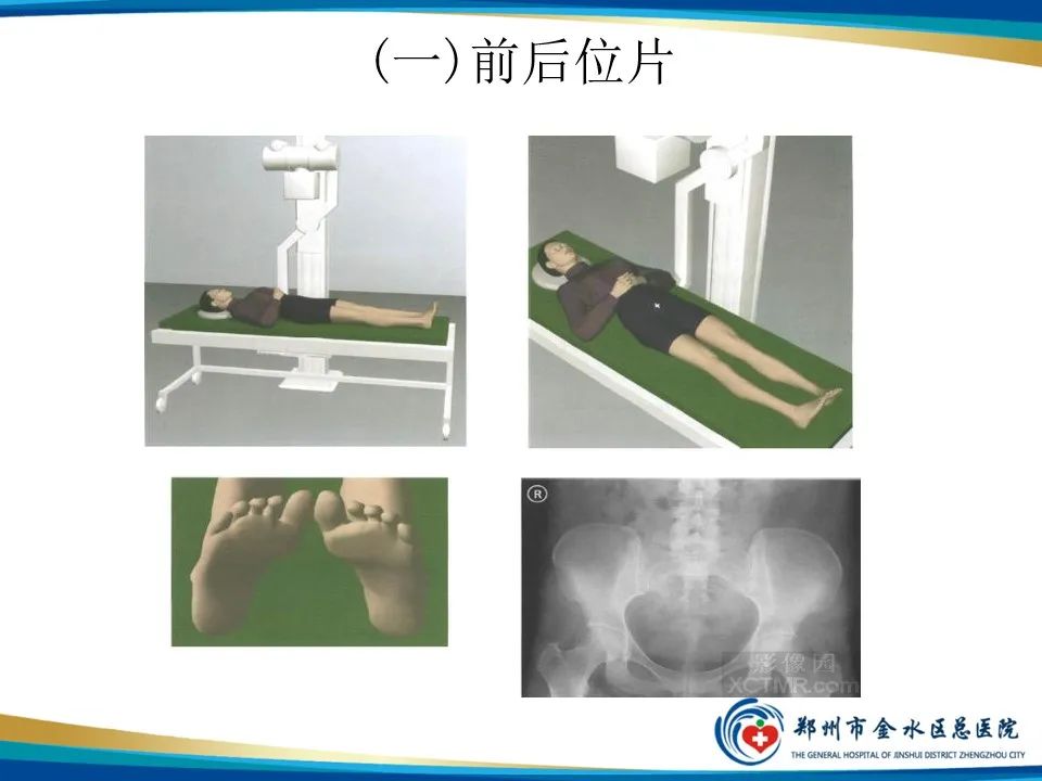 【PPT】骨盆拍片技术与临床意义-7