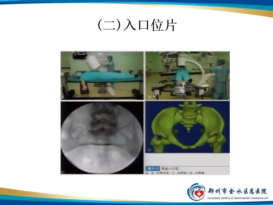 【PPT】骨盆拍片技术与临床意义-11