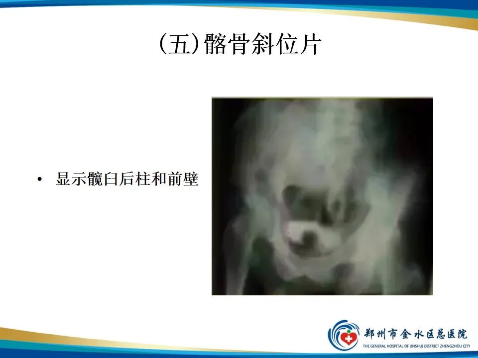 【PPT】骨盆拍片技术与临床意义-22