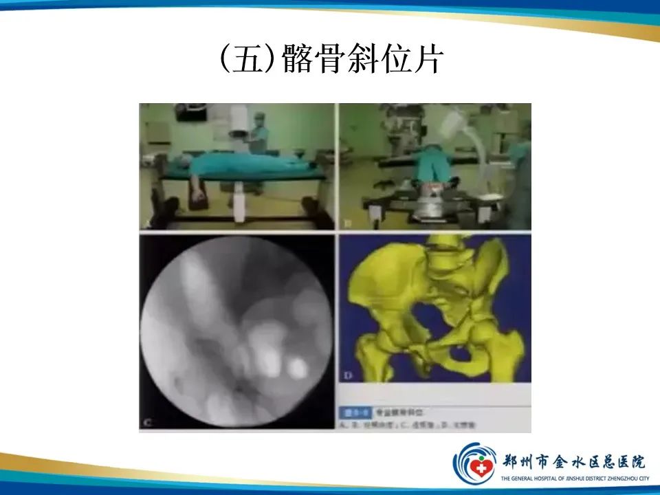 【PPT】骨盆拍片技术与临床意义-23
