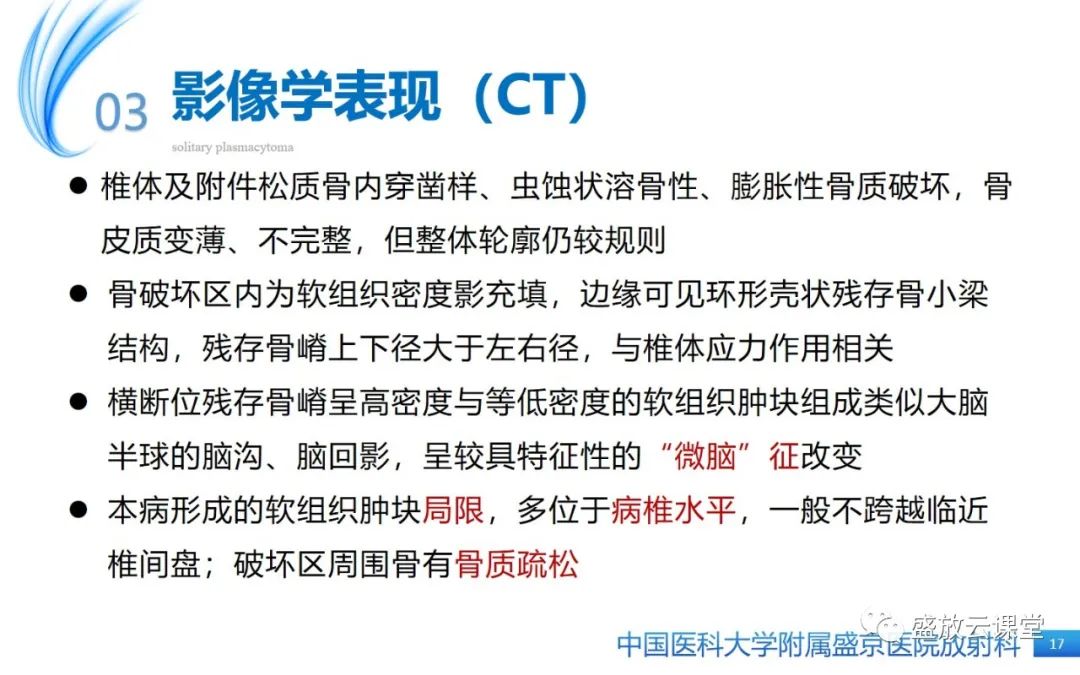 【PPT】孤立性浆细胞瘤-16