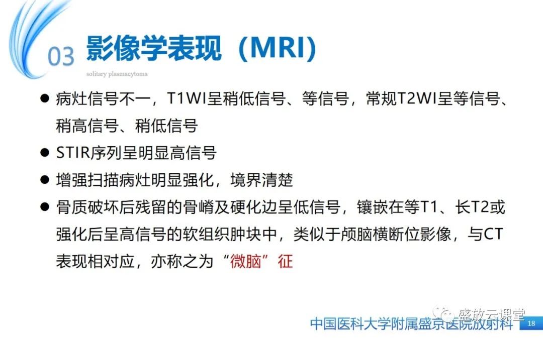 【PPT】孤立性浆细胞瘤-17