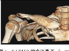 SAPHO综合征影像学表现