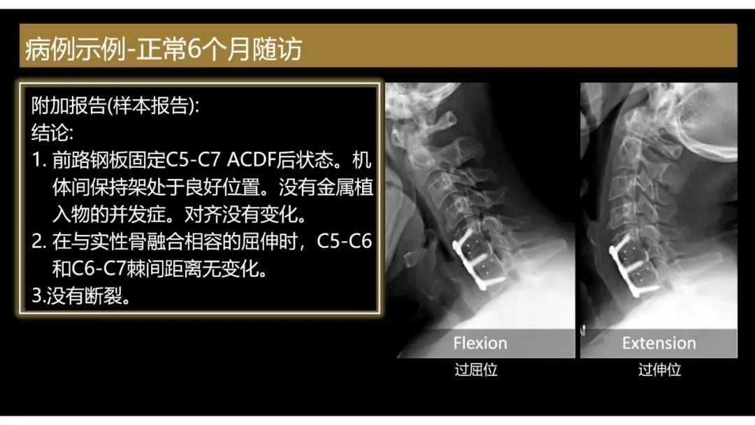 【PPT】评估围手术期脊柱:除了退行性椎间盘疾病和金属植入物的并发症外-8