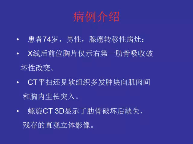 胸壁病变的影像诊断