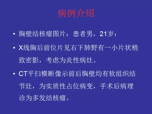 胸壁病变的影像诊断