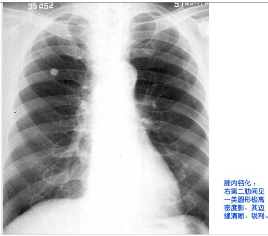100张典型X线图片