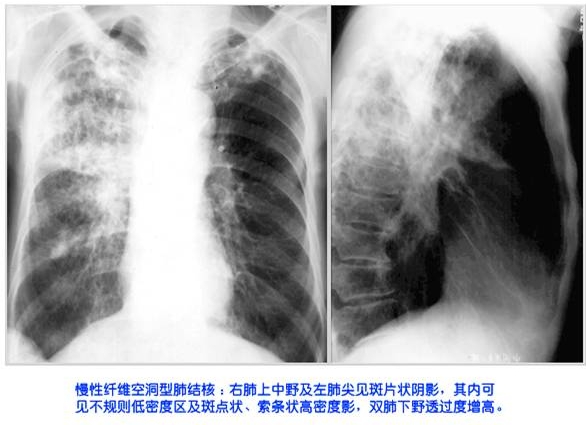 100张典型X线图片