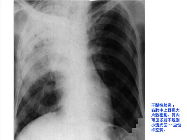 100张典型X线图片