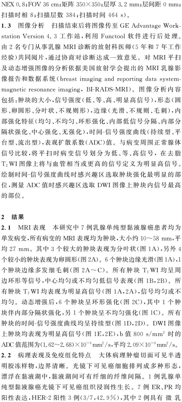 乳腺单纯型黏液腺癌的MRI表现