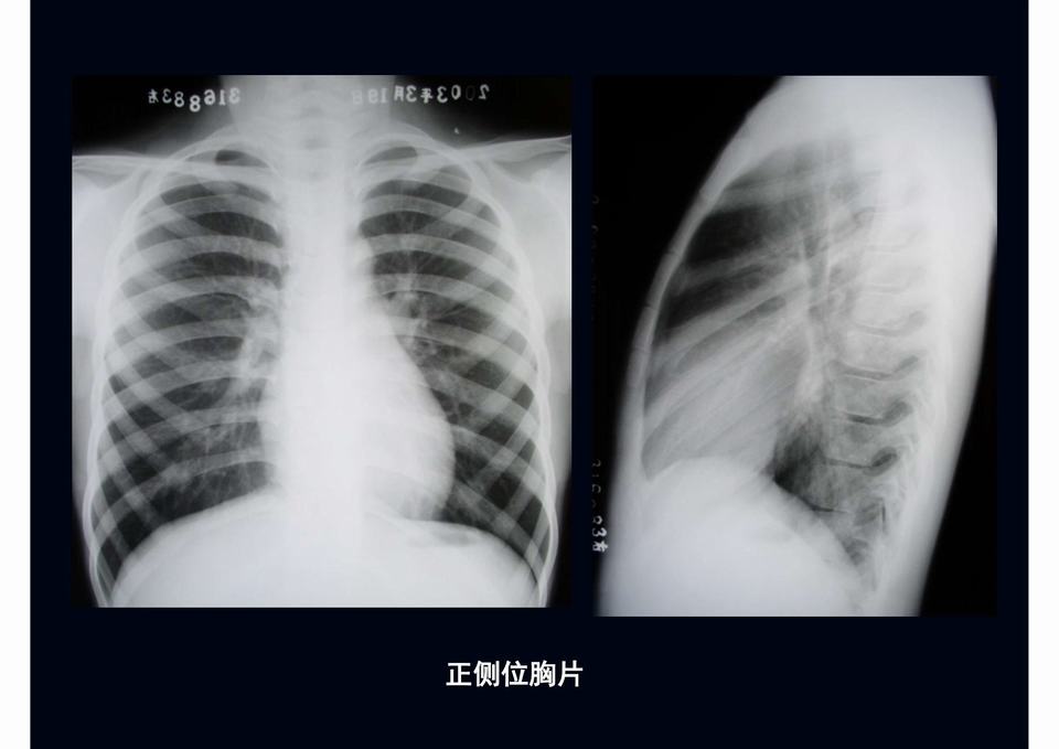 图05
