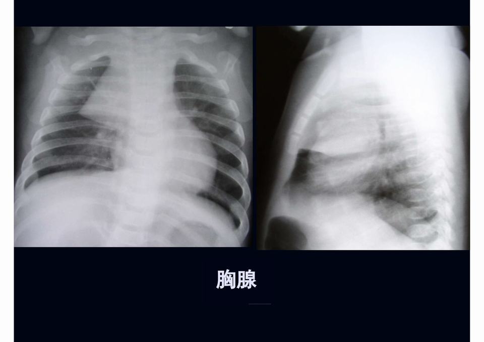 图07