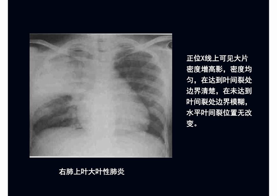 图12