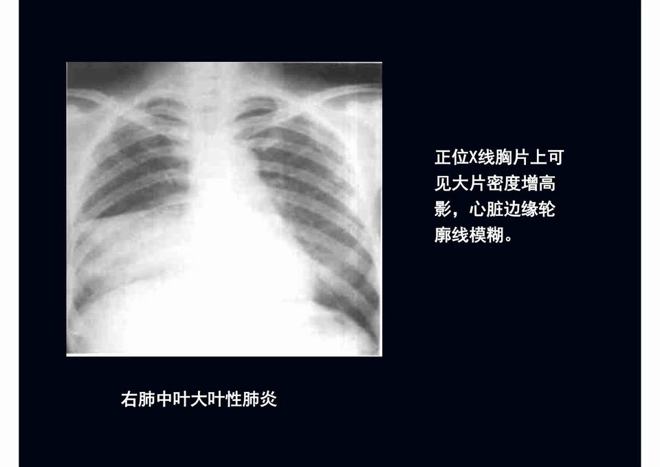 图13
