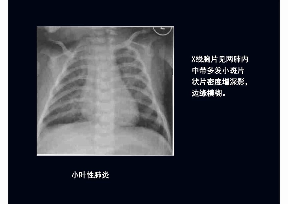 图15