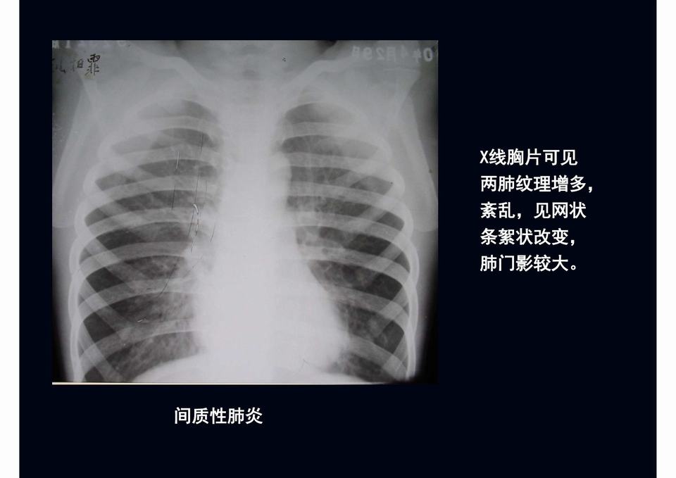 图17