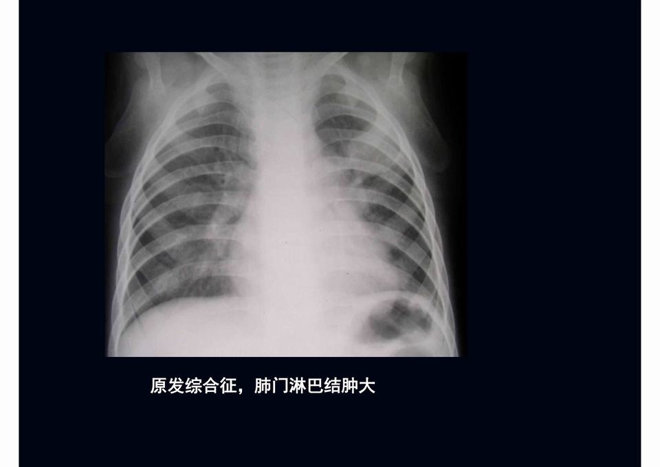 图21
