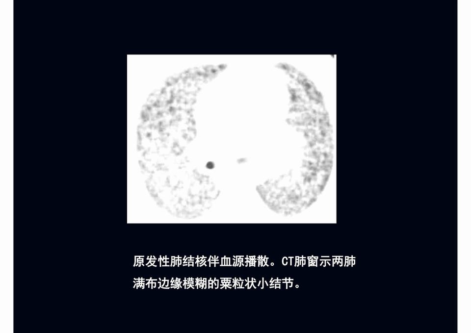 图22